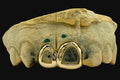 2 Gold Teeth: 14K 2 Piece Open Face image 0