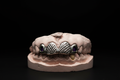 Dental model with a silver grill on a black background