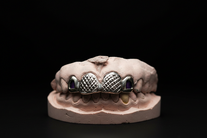 Dental model with a silver grill on a black background
